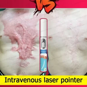 Rediscover Flawless Skin - Scar Care